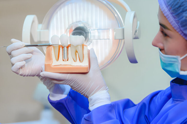 Understanding the Cost of All-on-4 Dental Implants