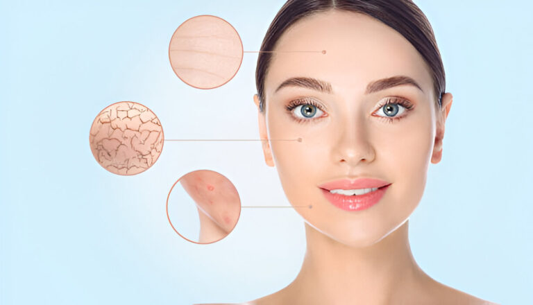 Lactic Acid Peel: Unlocking the Secrets to Vibrant Skin